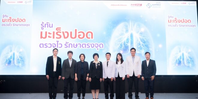 เอไอเอ จับมือ ศูนย์ศรีพัฒน์ มช. ย้ำความสำคัญของการดูแลสุขภาพเชิงป้องกัน ส่งเสริมการตรวจคัดกรองมะเร็งปอดด้วย Low-dose CT (LDCT)