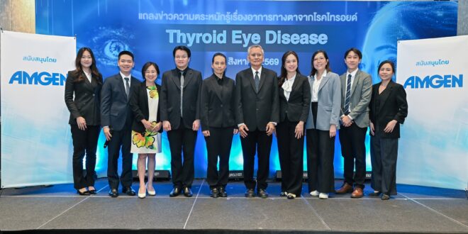 แพทย์เตือน ผู้ป่วยไทรอยด์อย่ามองข้ามอาการทางตา เพราะอาจเสี่ยงสูญเสียการมองเห็น TED ไม่ใช่แค่ตาโปน แพทย์ชี้โรคอาจกระทบการมองเห็นและคุณภาพชีวิต หากปล่อยไว้โดยไม่รักษา